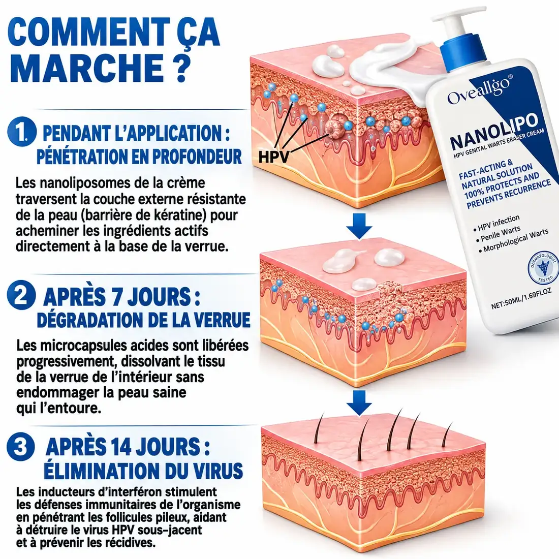 Comment agit la crème NanoLipo HPV