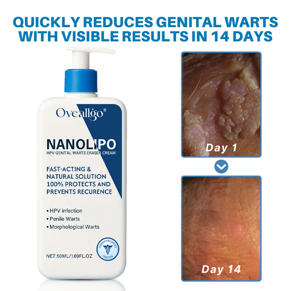 Crème NanoLipo HPV et photos de verrues génitales au jour 1 puis au jour 14
